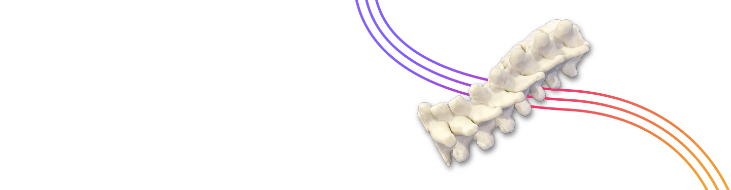 Basin 3d printed spine